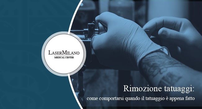 rimozione tatuaggi: quali sono quelli più facili e quelli più difficili da eliminare