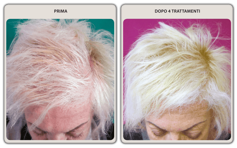 prima-dopo-donna-01