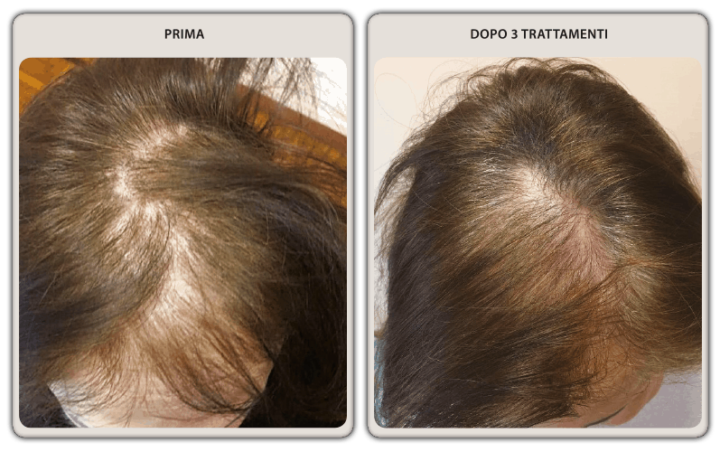 prima-dopo-donna-03