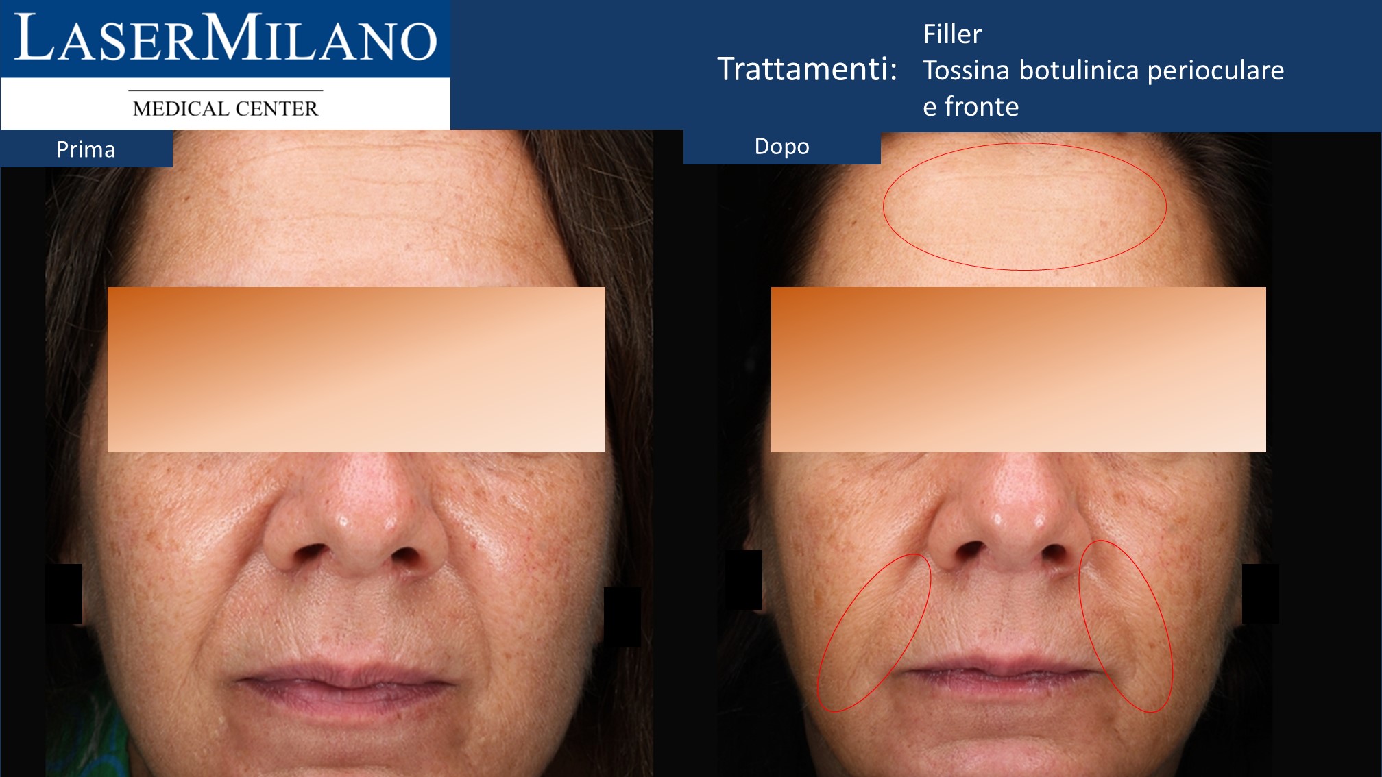Diapositiva10