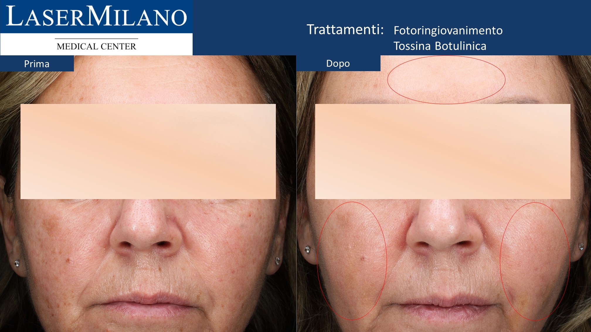 Diapositiva2