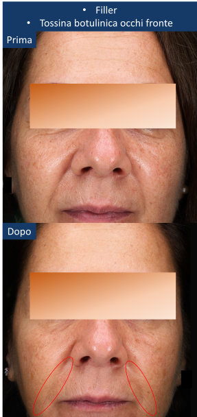 diapo10