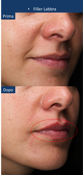 diapo11