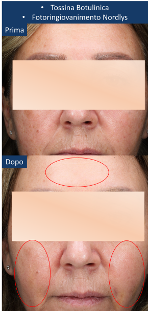 diapo2