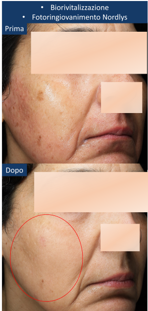 diapo3