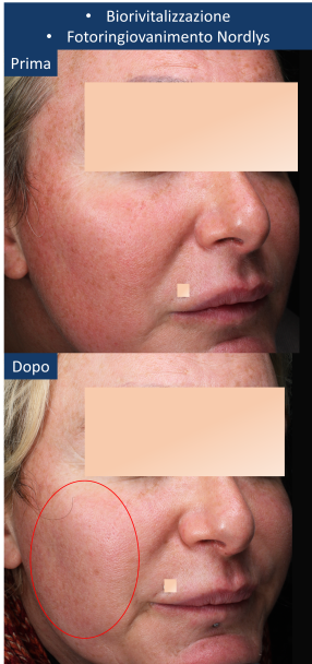 diapo4