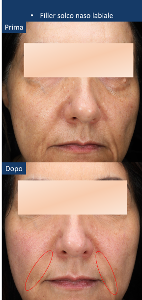 diapo5