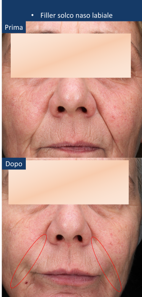 diapo6