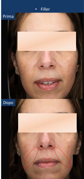 diapo7
