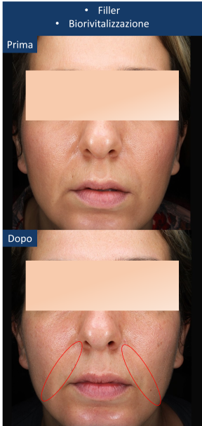 diapo9